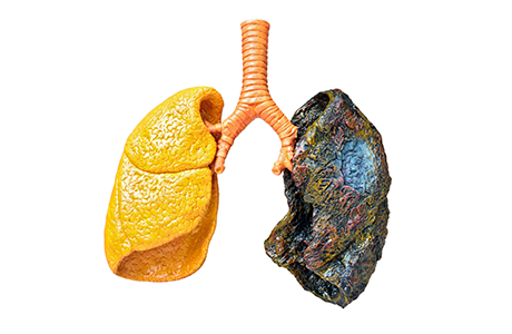 A Near Definitive Link Between Cigarette Smoke and Chronic Obstructive Pulmonary Disease